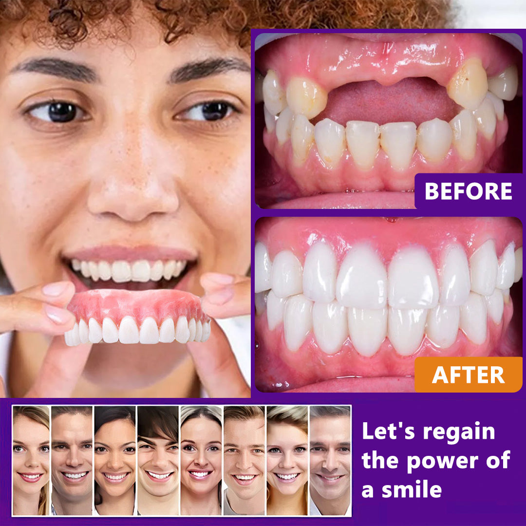 Bikendaโข Silicone Reline Denture Set๏ผ๐ฅ๐๐ข๐ฆ๐ข๐ญ๐๐ ๐ญ๐ข๐ฆ๐ ๐๐ข๐ฌ๐๐จ๐ฎ๐ง๐ญ ๐๐๐ฌ๐ญ ๐๐ ๐ฆ๐ข๐ง๐ฎ๐ญ๐๐ฌ๐ฅ)๐