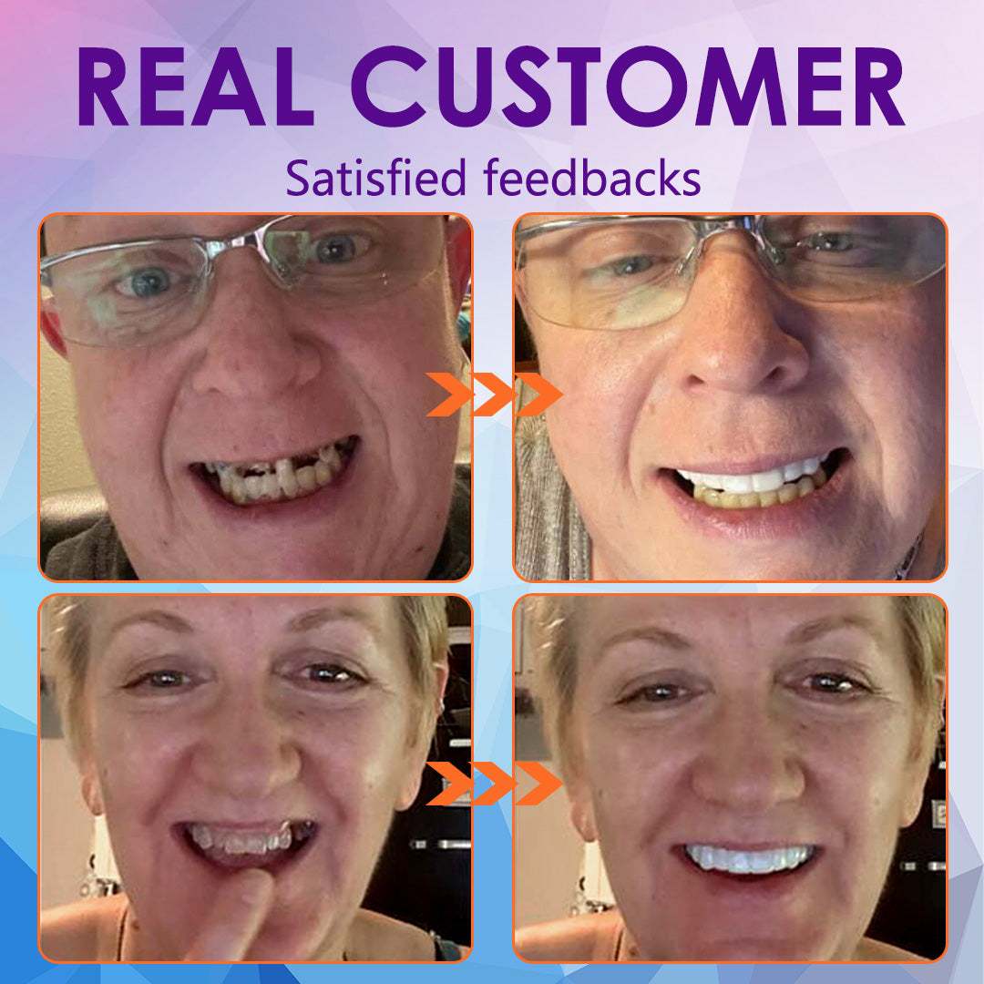 Bikendaโข Silicone Reline Denture Set๏ผ๐ฅ๐๐ข๐ฆ๐ข๐ญ๐๐ ๐ญ๐ข๐ฆ๐ ๐๐ข๐ฌ๐๐จ๐ฎ๐ง๐ญ ๐๐๐ฌ๐ญ ๐๐ ๐ฆ๐ข๐ง๐ฎ๐ญ๐๐ฌ๐ฅ)๐